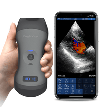 Load image into Gallery viewer, EagleView wireless handheld ultrasound compatible with Android device