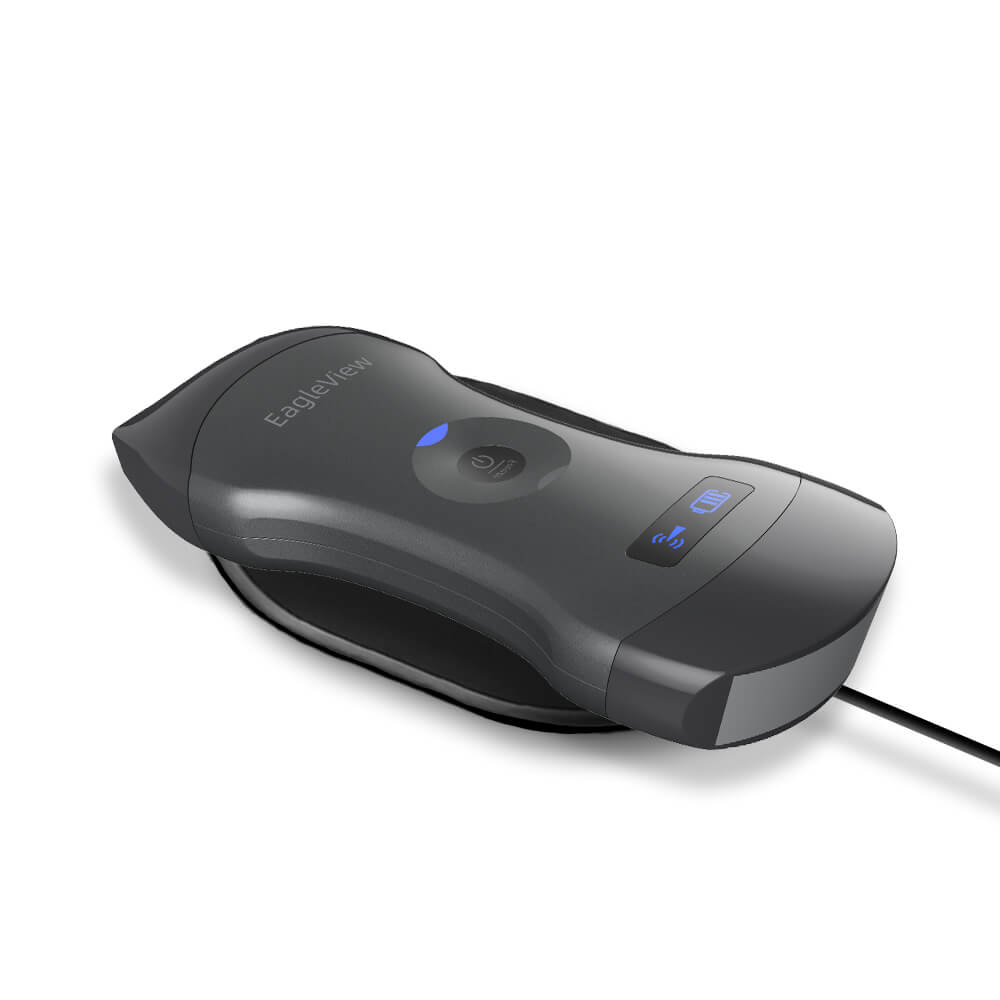 Wireless Probe Type Ultrasound Scanner