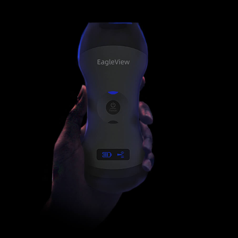 Wireless Probe Type Ultrasound Scanner