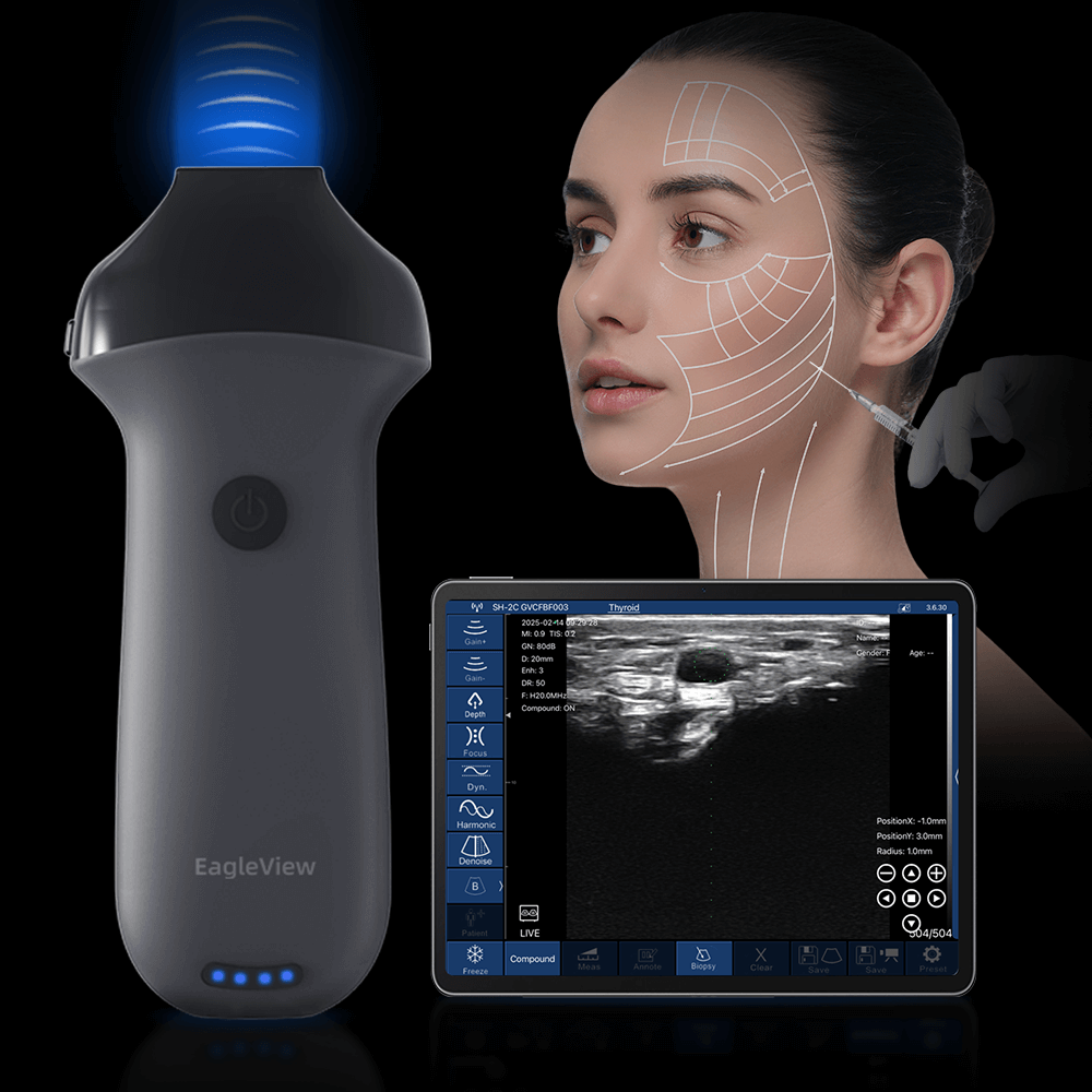 agleView Wireles Ultrasound for Aesthetics