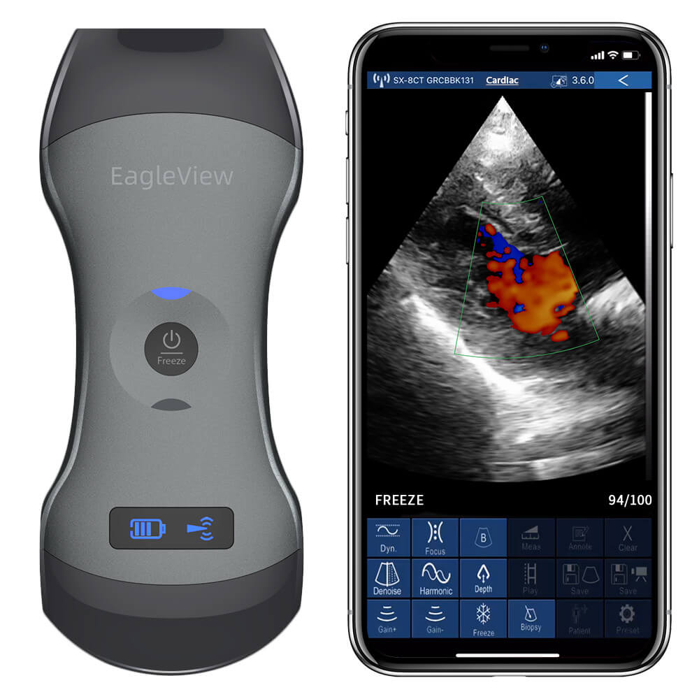 Eagleview wireless ultrasound scanner