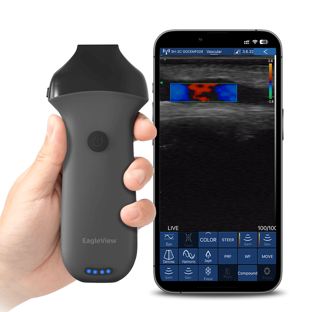 Eagleview portable aaesthetic  ultrasound scanner