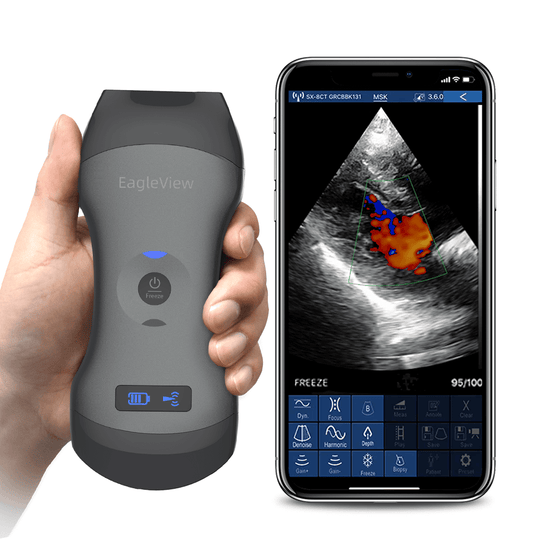 Eagleview portable ultrasound scanner