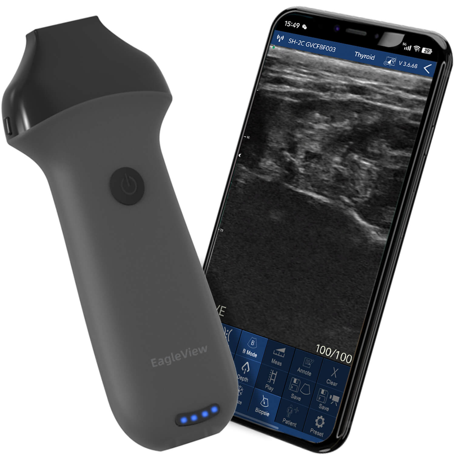 EagleView Portable Linear Ultrasound Machine with High Frequency ...
