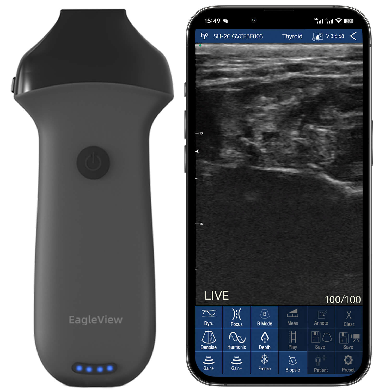 Eagleview 8P Linear Wireless Probe Type Ultrasound Scanner