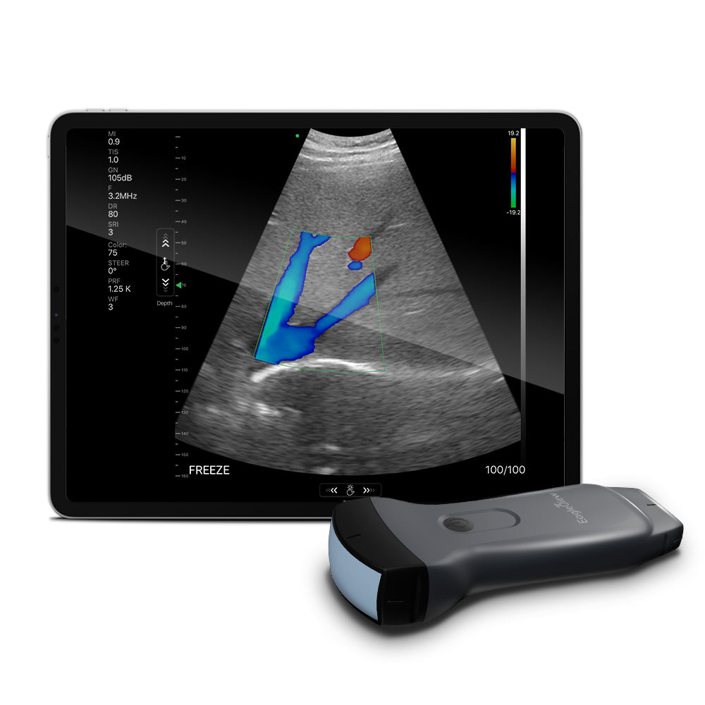 EagleView portable doppler is an ultrasound probe for iPad, iPhone and Android phone.