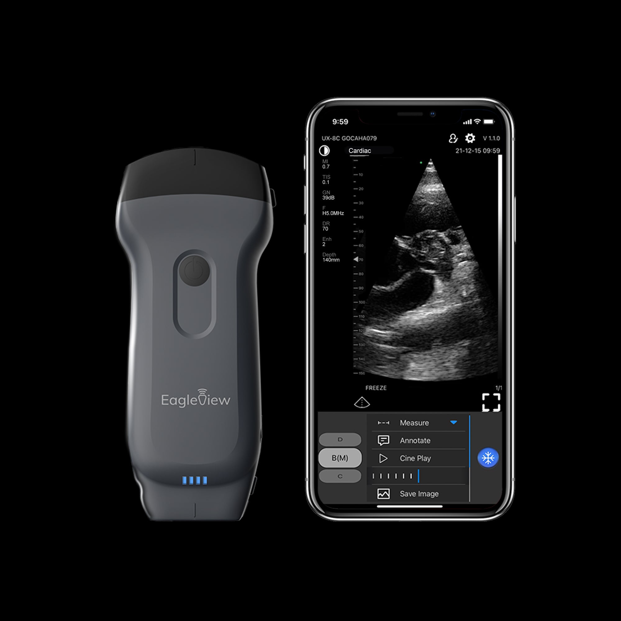 EagleView wireless portable ultrasound is a pocket-size POCUS that works as an curvilinear probe and a phased array probe at the same time.