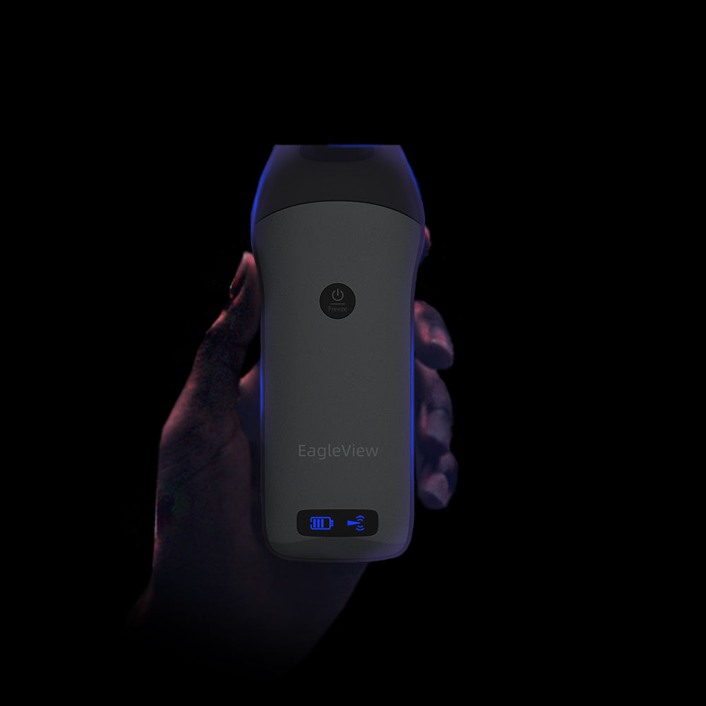 Aparatul cu ultrasunete portabil fără fir liniar EagleView are doar dimensiunea mâinii, cel mai portabil aparat cu ultrasunete de până acum.